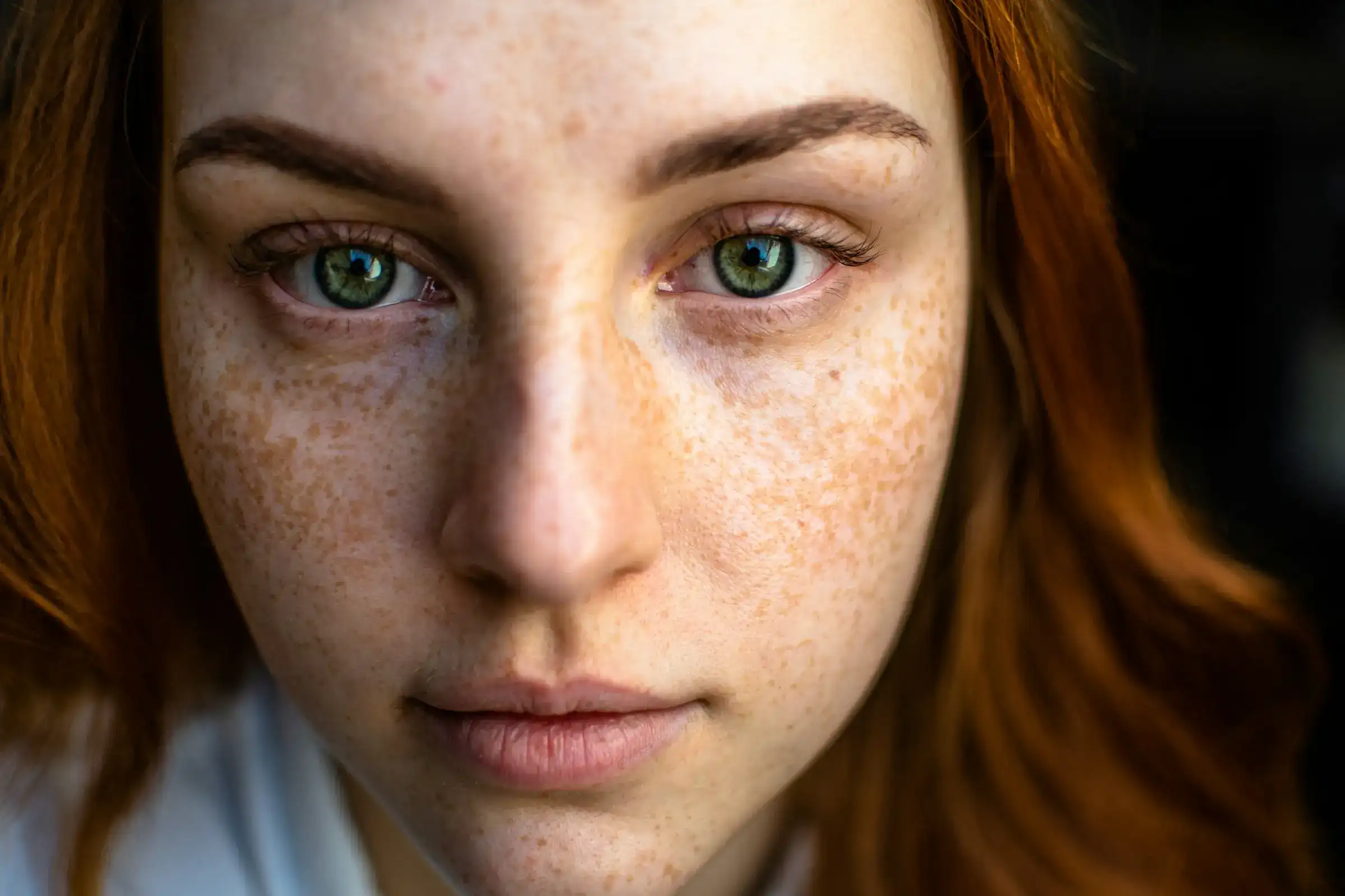 Close detail of a woman's face showing freckling and uneven pigmentation across the cheeks and nose