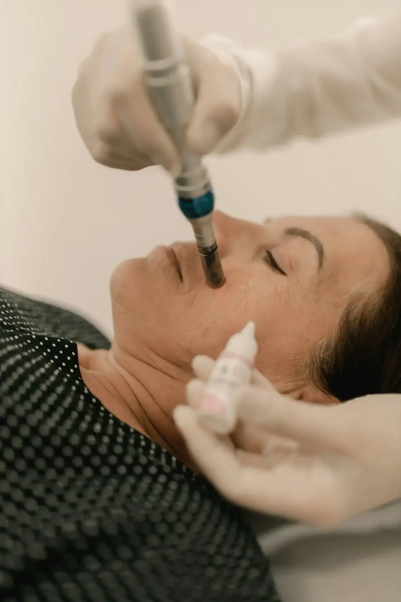 A practitioner moving a skin needling device across a client's cheek