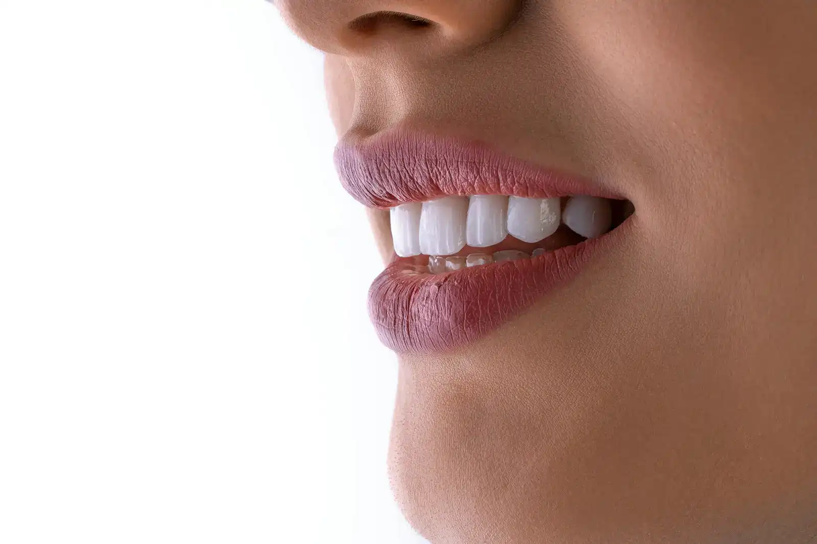 Teeth whitening treatment underway at Enrich Aesthetics, Wangi Wangi